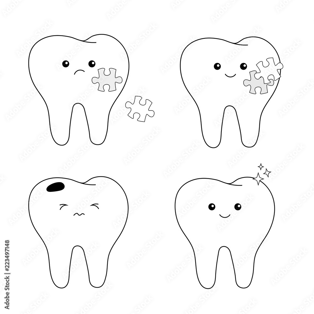 set of healthy and diseased teeth. concept of caries and its treatment