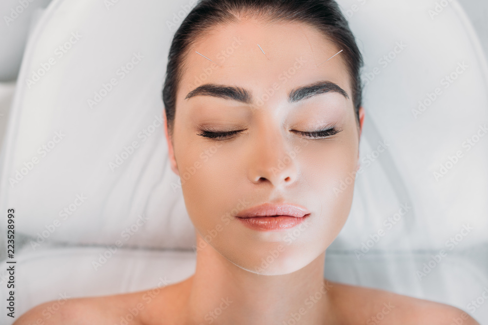 overhead view of woman relaxing while having acupuncture therapy in spa salon overhead view of woman relaxing while having acupuncture therapy in spa salon