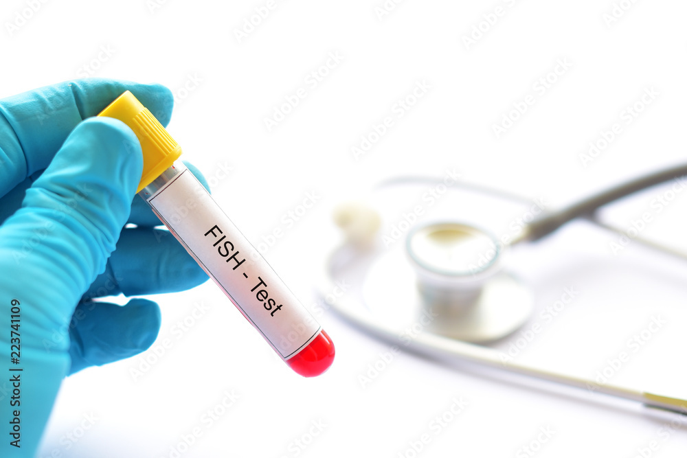 Naklejka premium Blood sample for fluorescence in situ hybridization or FISH test, laboratory method for chromosome study 