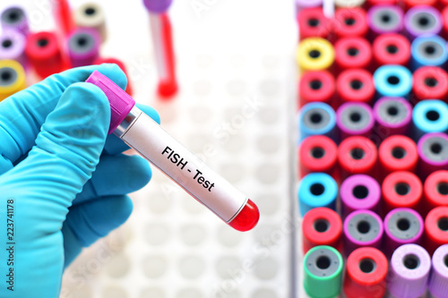 Εκτύπωση καμβά Blood sample for fluorescence in situ hybridization or FISH test, laboratory met