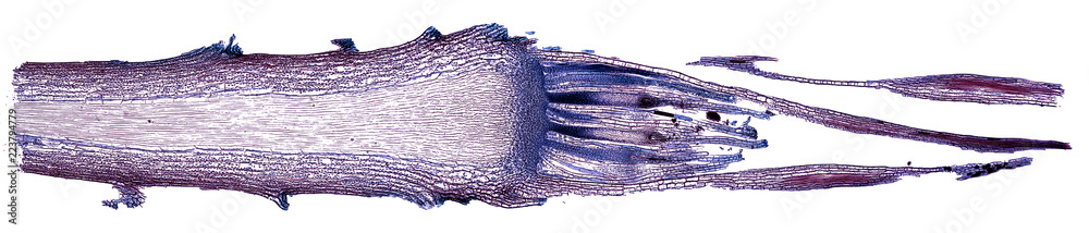 moss archegonium - cross section cut under the microscope – microscopic