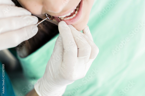 Fototapeta Naklejka Na Ścianę i Meble -  Devitalization of teeth on young patient