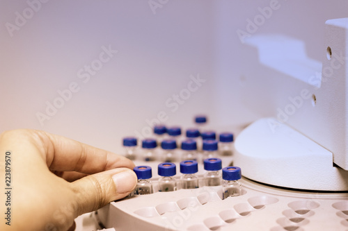 Scientist holds a chemical sample bottle. People hand holding a test tube vial sets for analysis.laboratory assistant inserting laboratory glass bottle in a chromatography vial.