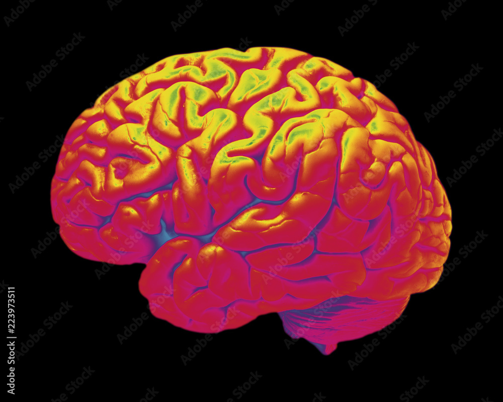 FALSE COLOUR IMAGE OF HUMAN BRAIN ON BLACK BACKGROUND FALSE COLOUR IMAGE OF HUMAN BRAIN ON BLACK BACKGROUND
