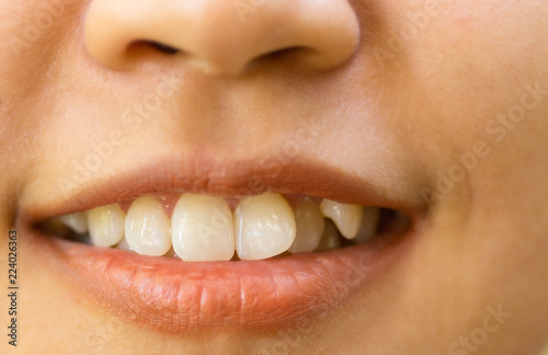 The teeth of women are unattractive teeth.