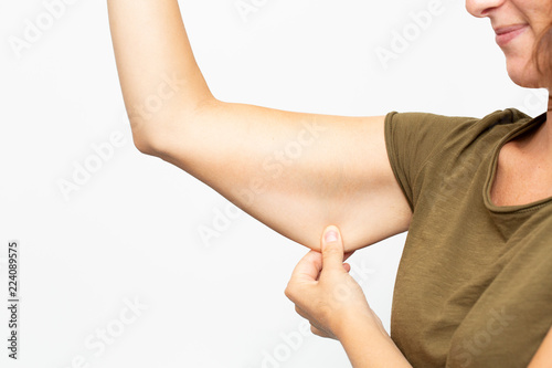 Woman with flabby skin in her arm