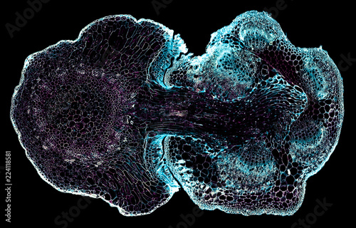 Quadro su tela dodder parasitic root - cross section cut under the microscope – microscopic vie