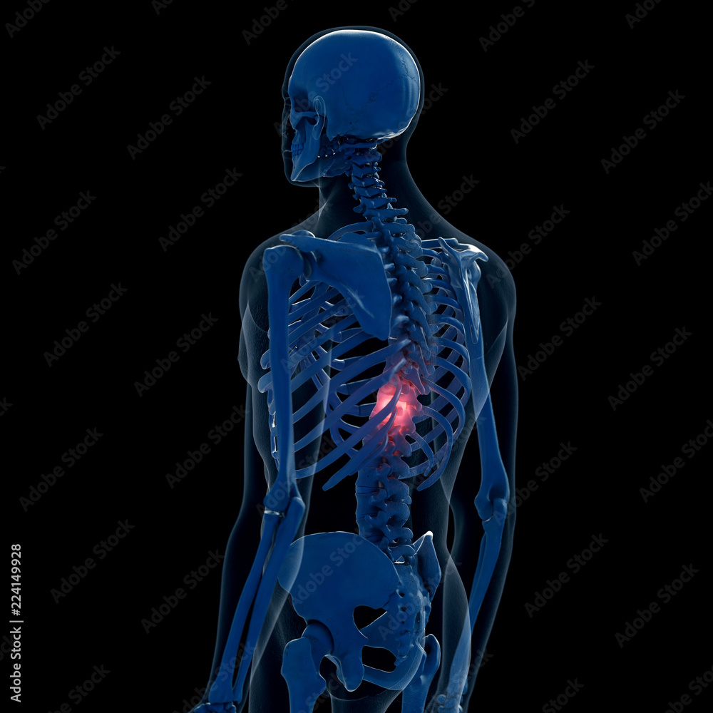 3d rendered medically accurate illustration of a painful back 3d rendered medically accurate illustration of a painful back