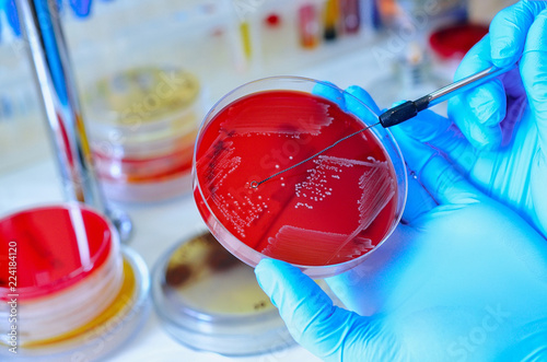Petri dish. Microbiological laboratory. Mold and fungal cultures. Bacterial research