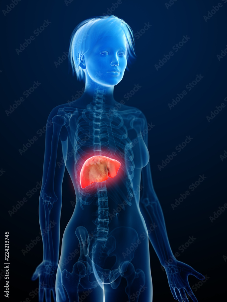 3d rendered medically accurate illustration of an inflamed liver 3d rendered medically accurate illustration of an inflamed liver