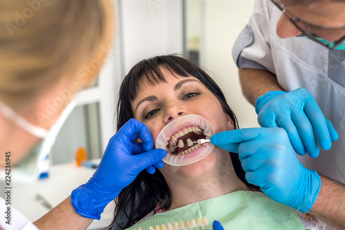 Fototapeta Naklejka Na Ścianę i Meble -  Patient's teeth comparing with sampler in doctor's hands