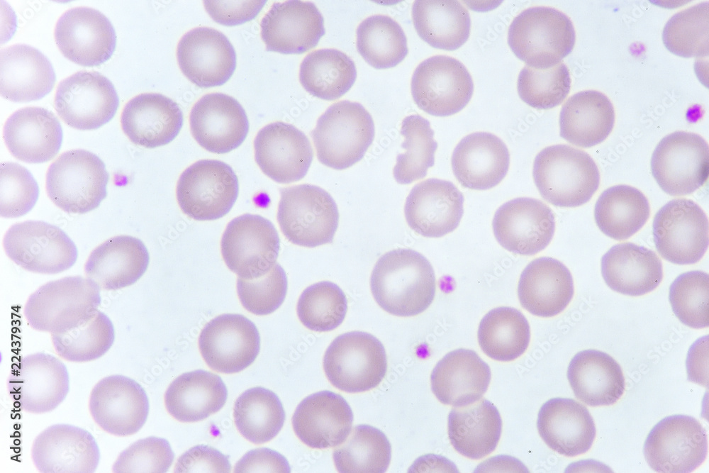 Red blood cells and platelet in blood smear, analyze by microscope Stock Photo Adobe Stock