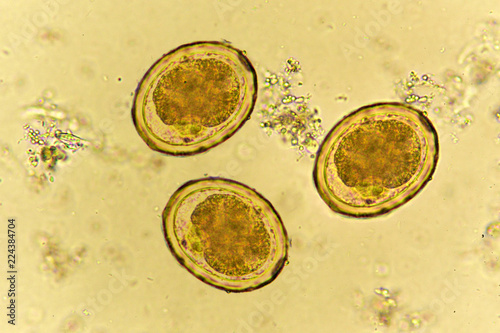 Eggs of Ascaris lumbricoides (roundworm) in stool, analyze by microscope
 photo