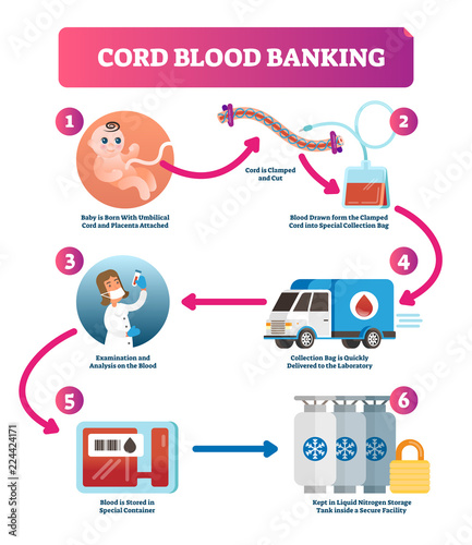 Cord blood banking infographic vector illustration. Explanation diagram.