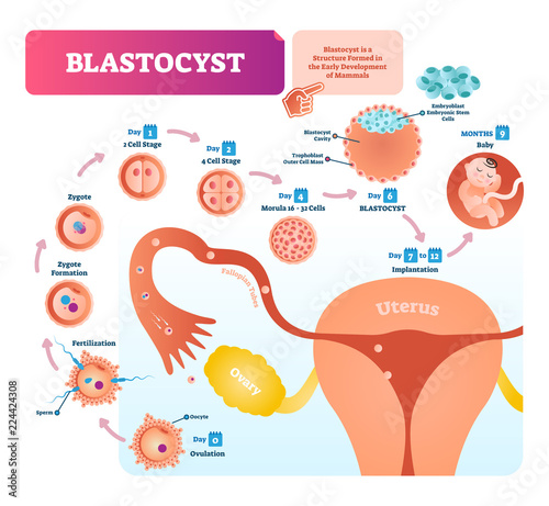 Blastocyst vector illustration infographic. Biological embryo early stage.