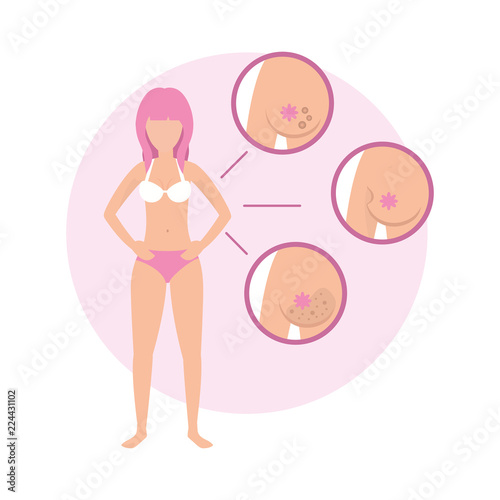 woman breast cancer and medical treatment