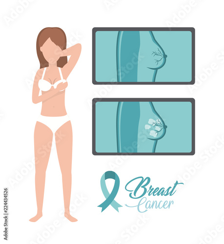 woman breast cancer diagnosis prevention