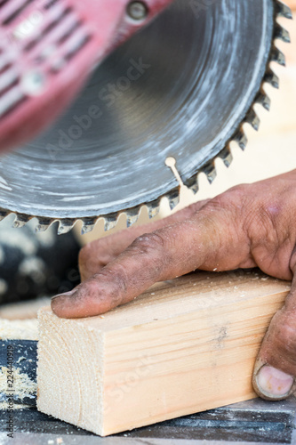 Injury when working with a saw. Place for your text.