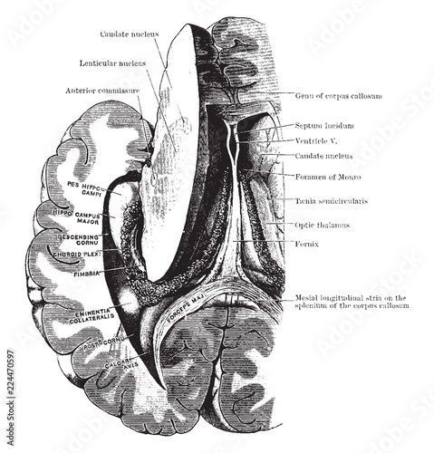 Dissection to Show Ventricle and Fornix, vintage illustration