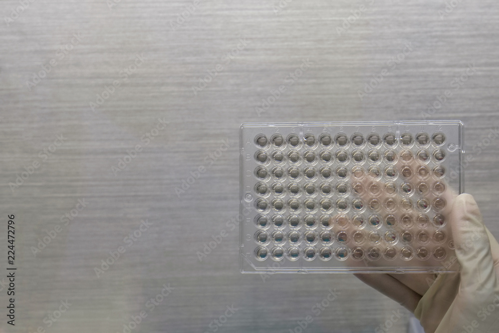 Closeup image of Screening the cell cytotoxicity by MTT assay in microtiter plate. Mtt is used to study the cell viability measure of cellular activity as an indicator of cell damage or cytotoxicity w Closeup image of Screening the cell cytotoxicity by MTT assay in microtiter plate. Mtt is used to study the cell viability measure of cellular activity as an indicator of cell damage or cytotoxicity w