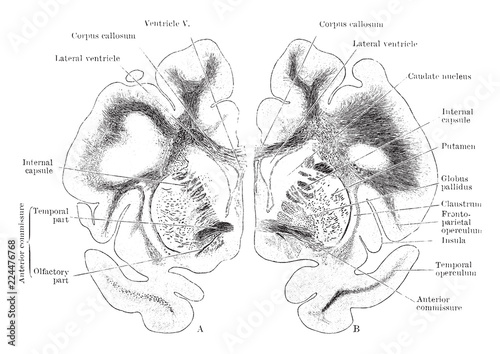 Coronal Sections of the Cerebral Hemispheres, vintage illustration.