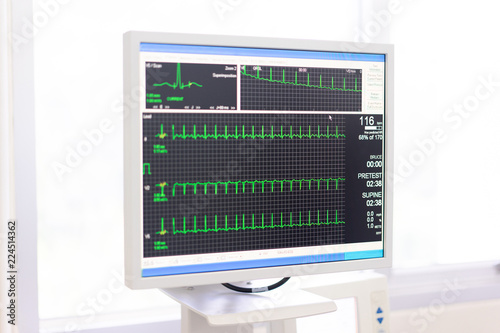 The doctor check heart rate and pulse of patient by running test for protect the heart attack.