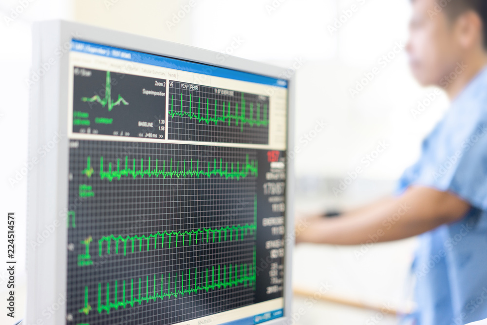 Fototapeta premium The doctor check heart rate and pulse of patient by running test for protect the heart attack.