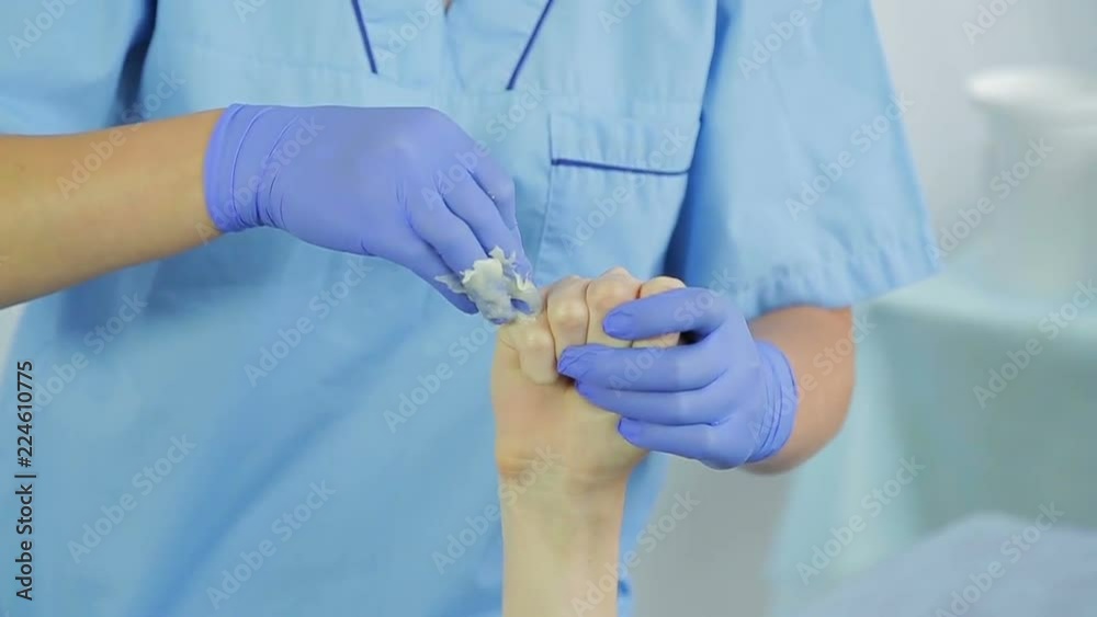 A female beautician makes a shugaring of the client's hands. A female beautician makes a shugaring of the client's hands.