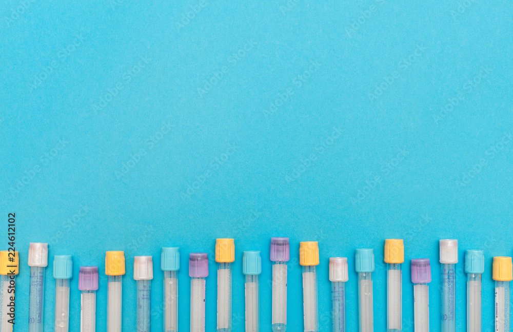 Flat lay, top view. Hematology blood analysis report with colorful sample collection tubes. Blood samples in a rack with space for text Flat lay, top view. Hematology blood analysis report with colorful sample collection tubes. Blood samples in a rack with space for text