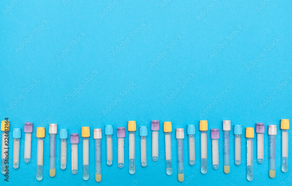 Flat lay, top view. Hematology blood analysis report with colorful