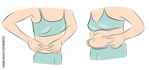 women with and without stomach. losing weight. excess weight. vector illustration.