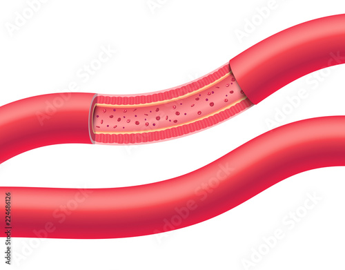Anatomical vessels