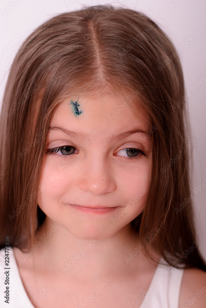 Physical injury blood wound skin human child pain. Physical injury blood wound skin human child pain.