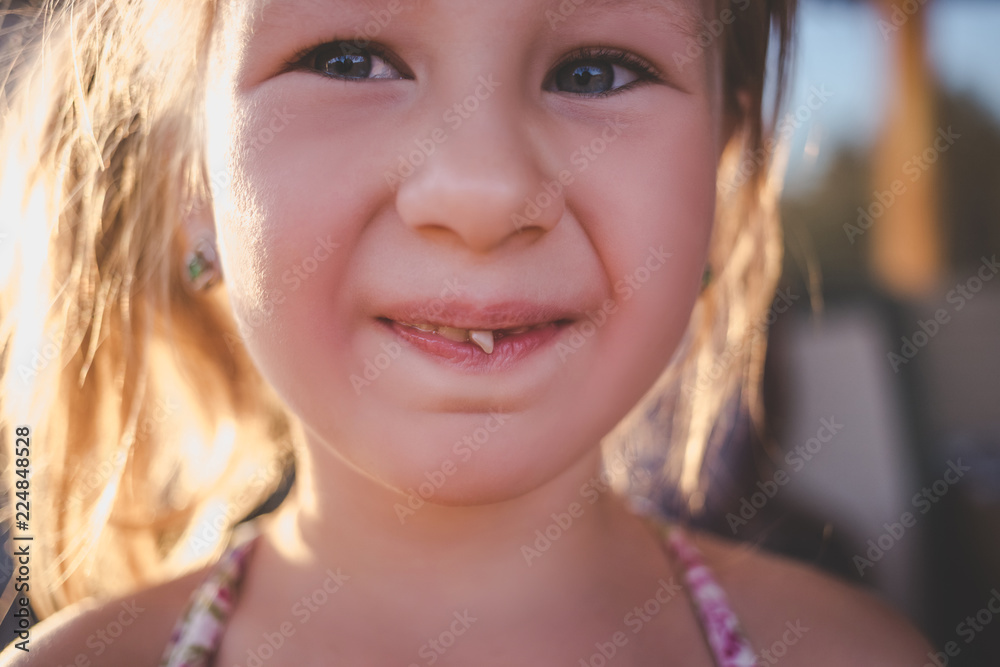 Fototapeta premium Portrait of a little girl with an outstretched milk tooth