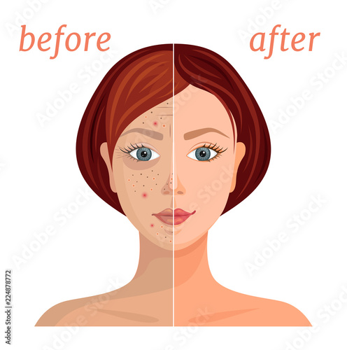 Banner with the image of a woman's face before and after the application of cosmetics. Comparison of problematic dull skin and healthy, clean. Vector illustration.