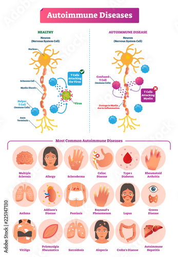 Autoimmune diseases vector illustration. Various illness collection set. photo
