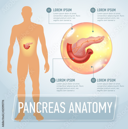 Vector pancreas infographics banner illustration. Medical Poster
