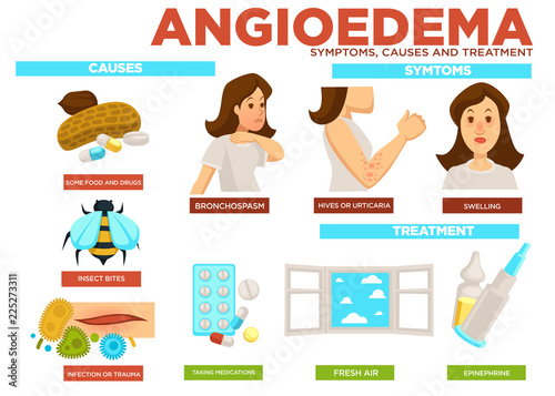 Angioedema symptom, causes and treatment of disease vector