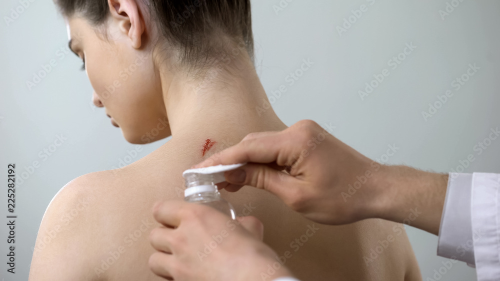 Physician cleaning wound on ladies back with antiseptic, first aid to patient Physician cleaning wound on ladies back with antiseptic, first aid to patient
