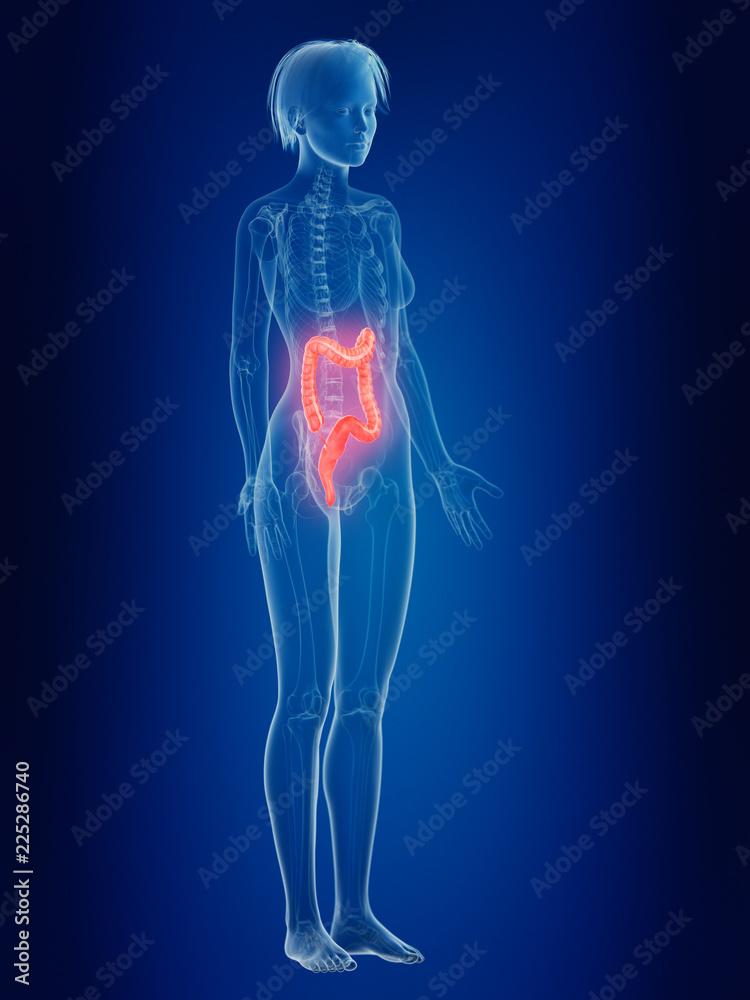 3d rendered medically accurate illustration of a females painful colon 3d rendered medically accurate illustration of a females painful colon
