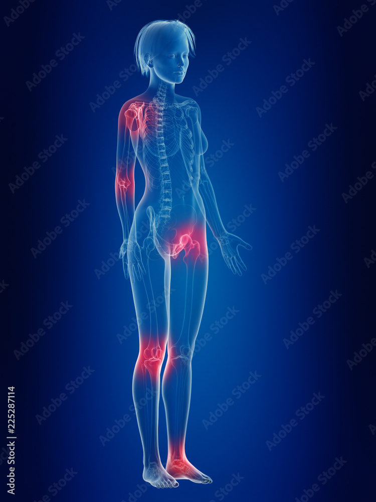 3d rendered medically accurate illustration of a females painful joints 3d rendered medically accurate illustration of a females painful joints