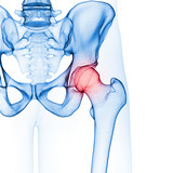 3d rendered medically accurate illustration of the hip joint