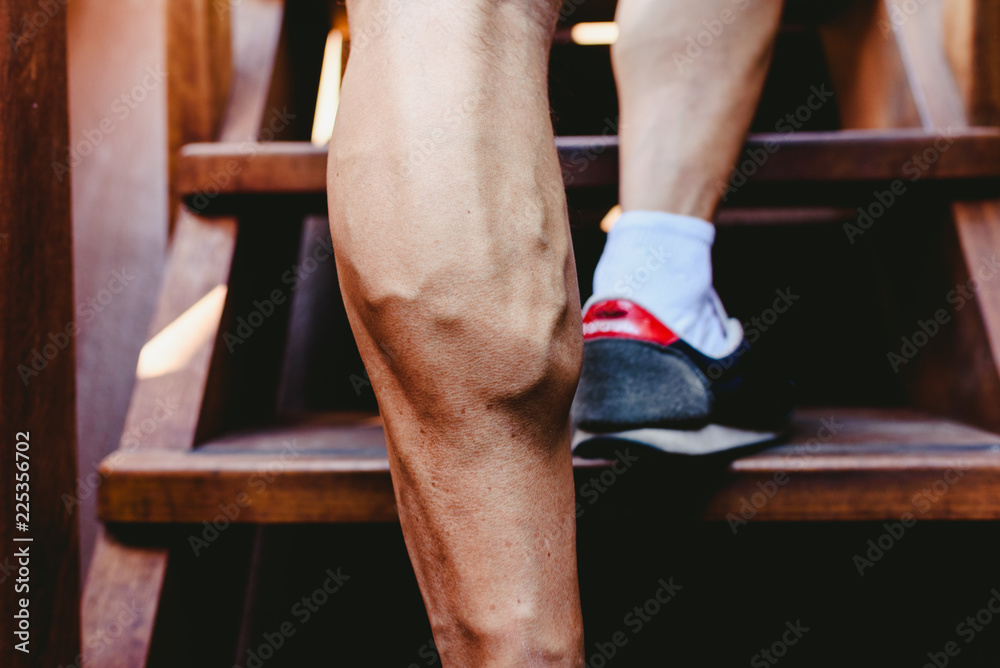 Large visible veins of calf muscles in a man's leg.