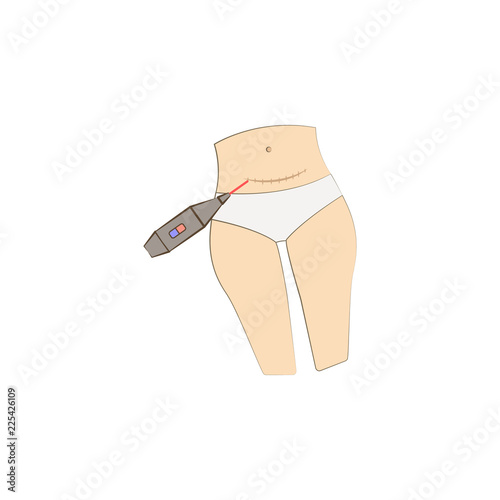 Abdomen scar remove laser colored icon. Element of colored cosmetology laser icon for mobile concept and web apps.Thin line Abdomen scar remove laser icon can be used for web