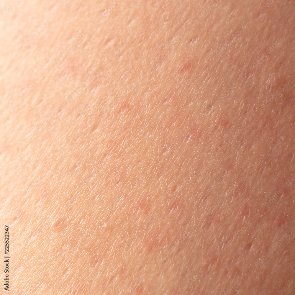 Girl's skin after depilation as a background Girl's skin after depilation as a background
