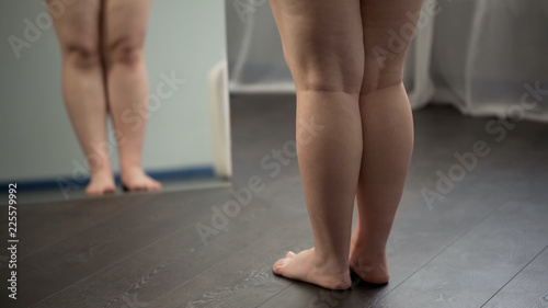 Legs of excess weight woman, flat feet and cellulite issue, obesity problems photo