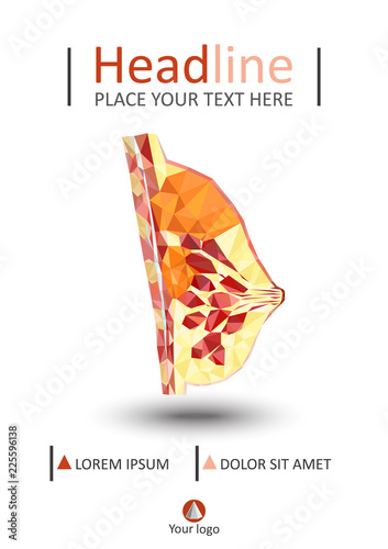 Women breast cross section in low poly. Realistic 3d medical human organ cancer. For medical education, for Clinics, Universities, Schools. Medical book, journal, research. Vector