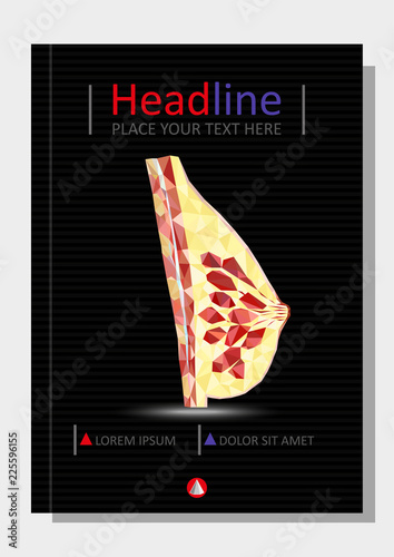 Women breast cross section in low poly. Realistic 3d medical human organ cancer. For medical education, for Clinics, Universities, Schools. Medical book, journal, research. Vector