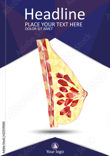Women breast cross section in low poly. Realistic 3d medical human organ cancer. For medical education, for Clinics, Universities, Schools. Medical book, journal, research. Vector