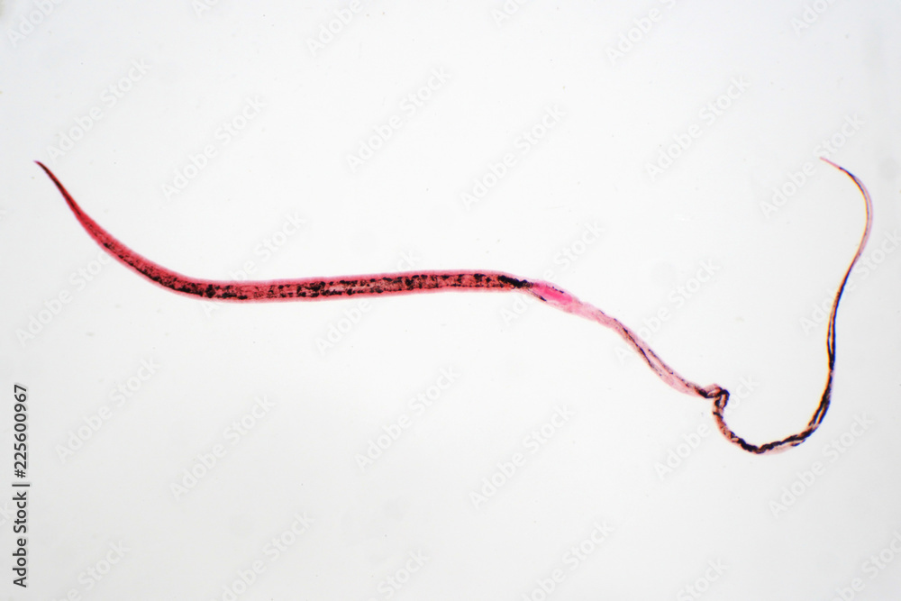 whipworm (Trichuris trichiura) is parasitic helminthic nematode (roundworm) whipworm (Trichuris trichiura) is parasitic helminthic nematode (roundworm)